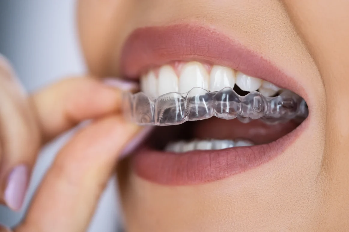 مدة دراسة تخصص تقويم الاسنان