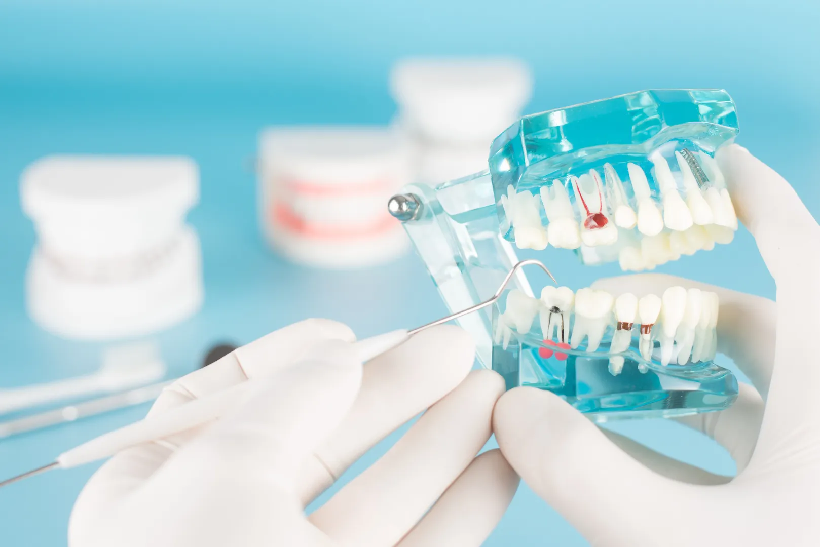تكاليف دراسة ماجستير طب الاسنان في مصر