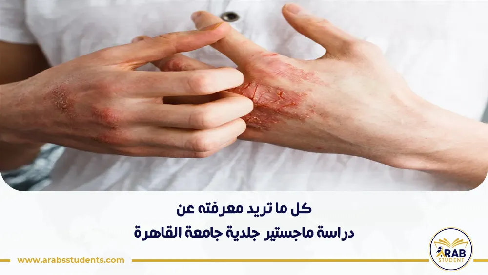 دراسة ماجستير جلدية جامعة القاهرة