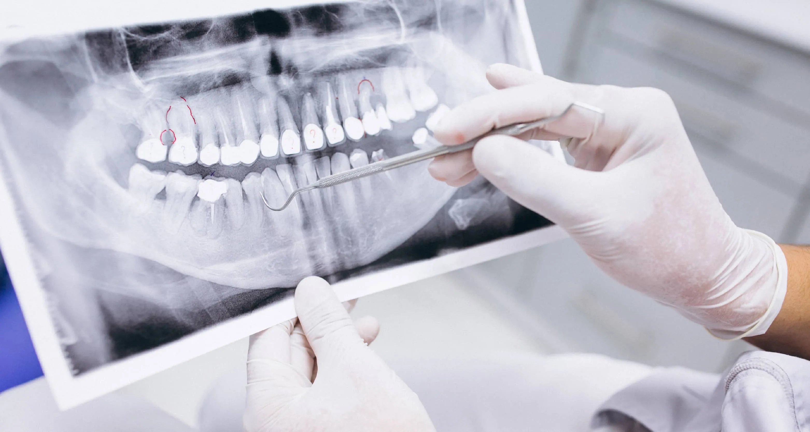 تكلفة ماجستير طب الأسنان في مصر